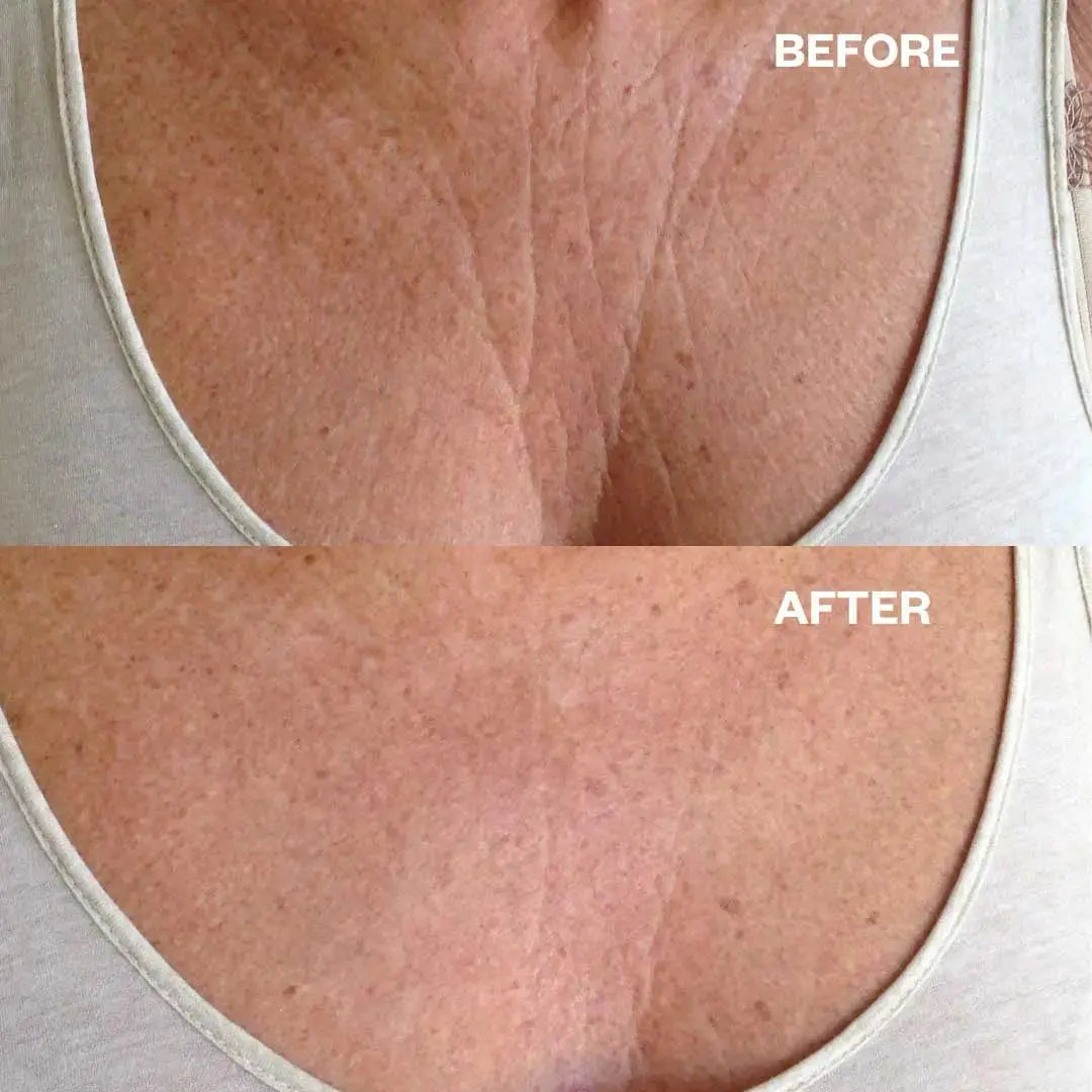 Chest Wrinkle Patch Wrinkles Schminkles