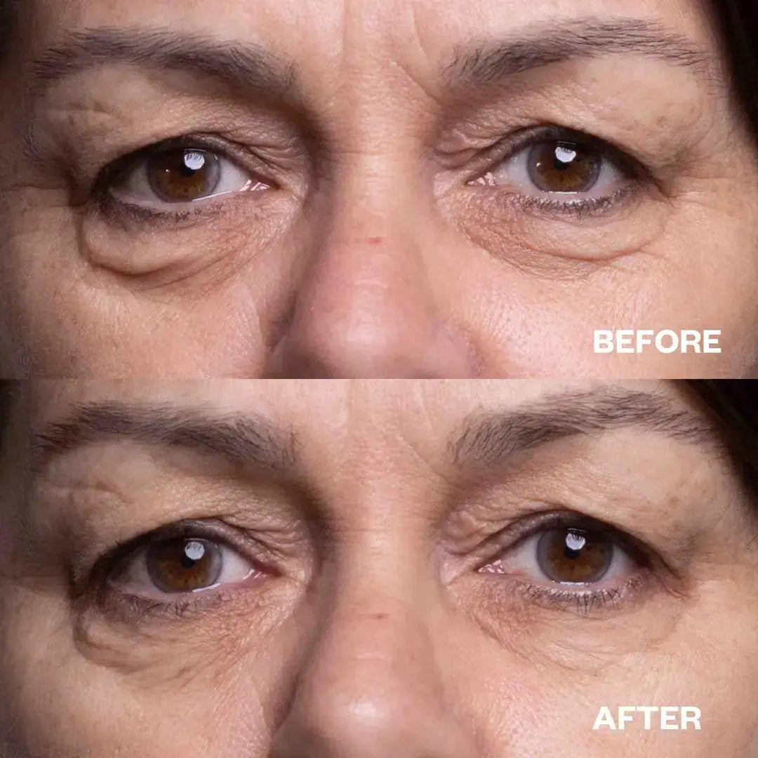 Eye Wrinkle Patches Wrinkles Schminkles