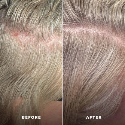 EverBoost Multi-Peptide Scalp Serum Everist