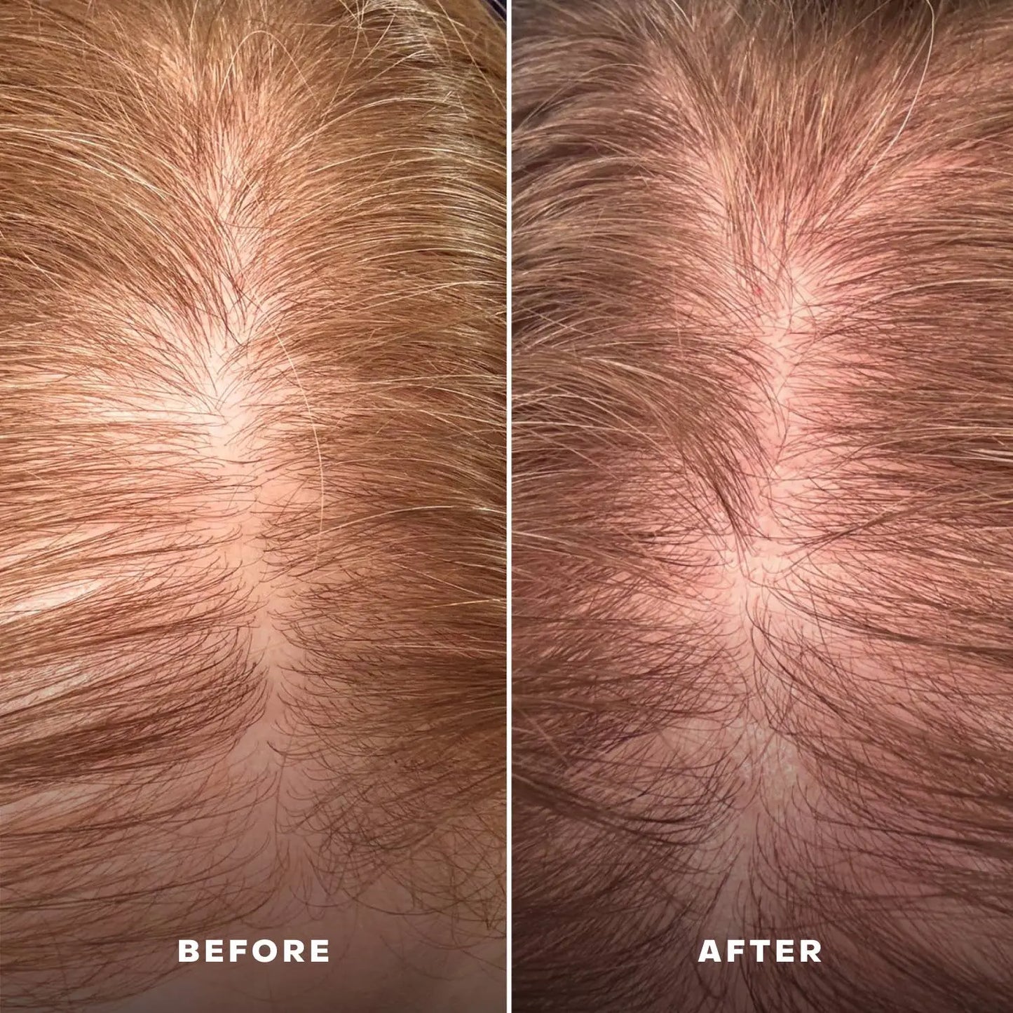EverBoost Multi-Peptide Scalp Serum Everist
