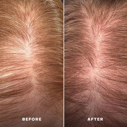 EverBoost Multi-Peptide Scalp Serum Everist