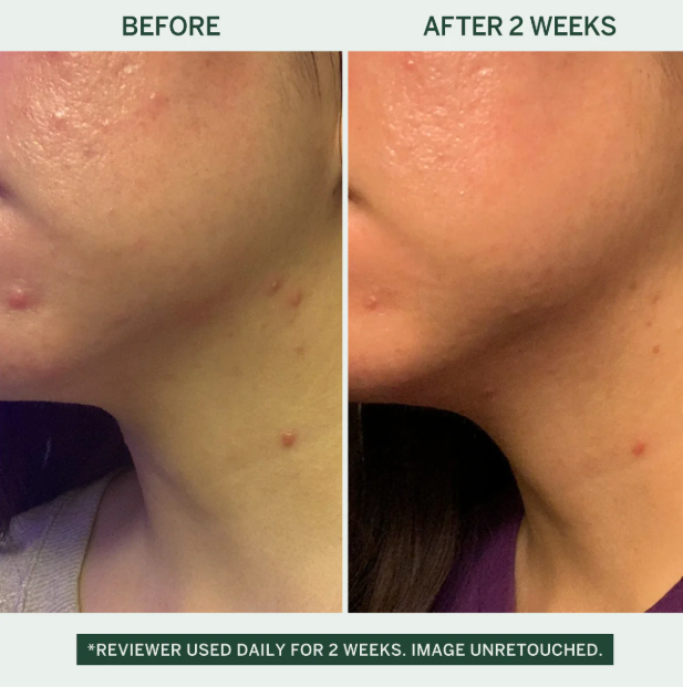 Barrier Cream w/Hyaluronic Acid - Korean Beauty - Urban Calm: Standard