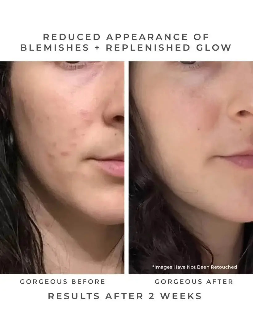 OASIS Deep Pore Gel Cleanser: Chlorophyll + Botanical BHA Earth Harbor Naturals