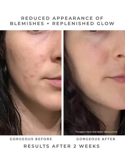 OASIS Deep Pore Gel Cleanser: Chlorophyll + Botanical BHA Earth Harbor Naturals