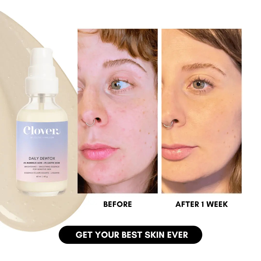 Daily Dewtox Smoothing & Brightening Essence Clover By Clove + Hallow