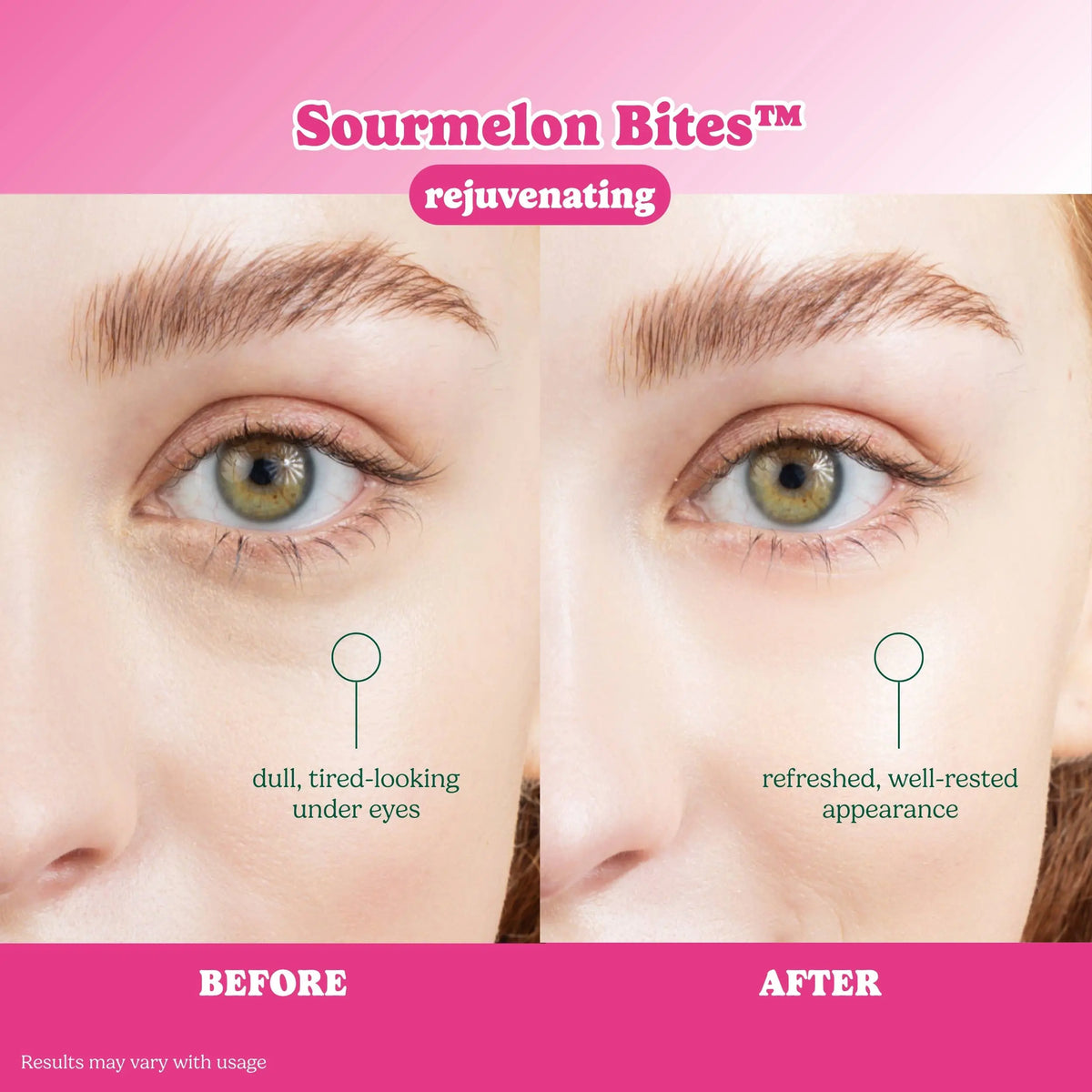 ESW x SmartSweets Rejuvenating Sourmelon Bites™ Eye Patches: 10 pc PDQ