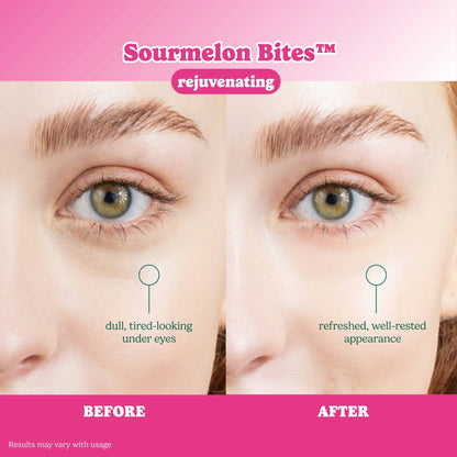 ESW x SmartSweets Rejuvenating Sourmelon Bites™ Eye Patches: 10 pc PDQ