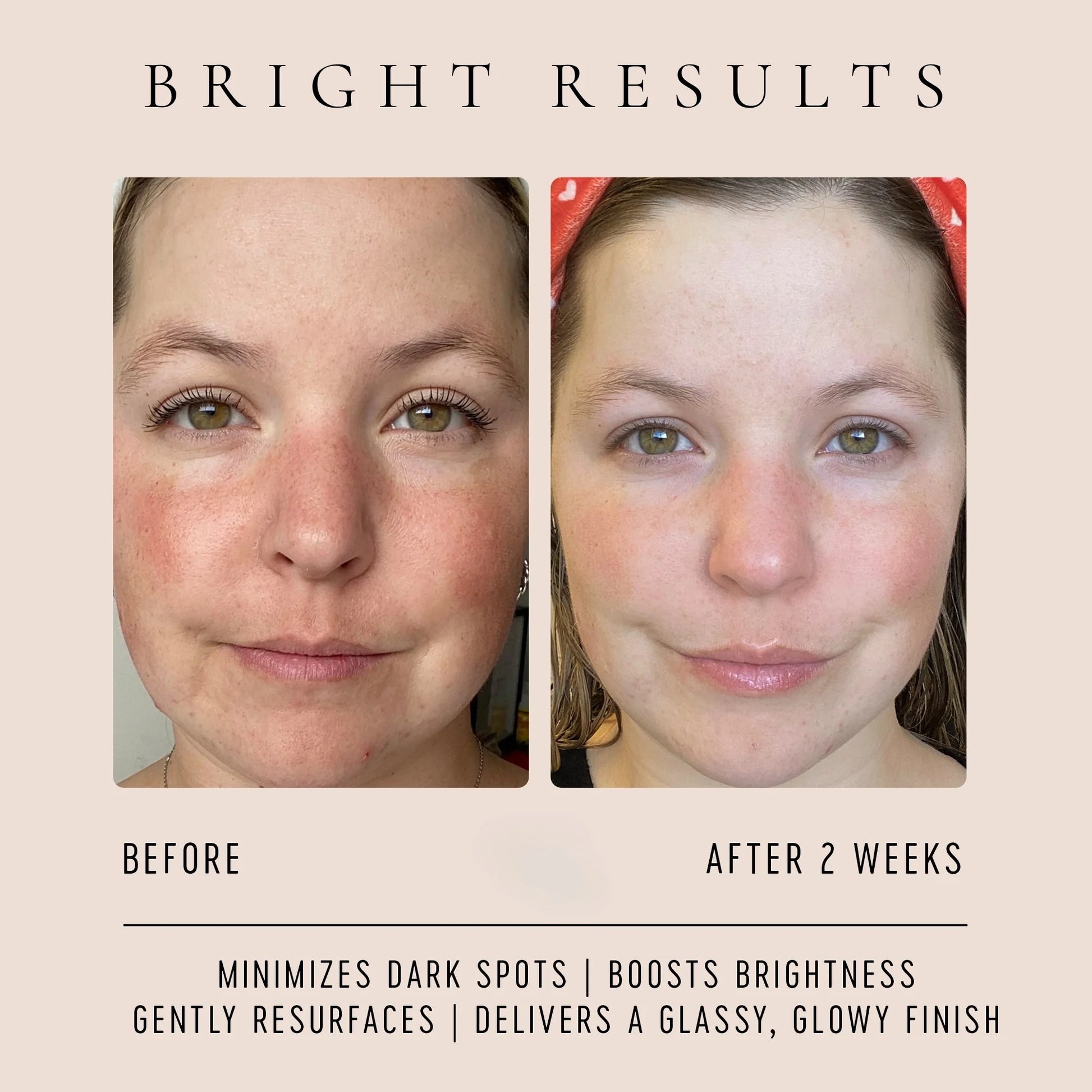 Vitamin C Glow Drops WELLSPRING