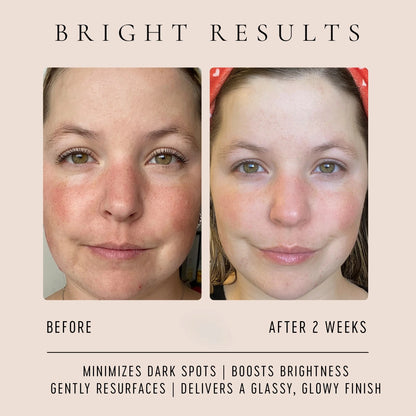 Vitamin C Glow Drops WELLSPRING