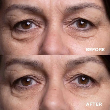 Eye Wrinkle Patches Wrinkles Schminkles